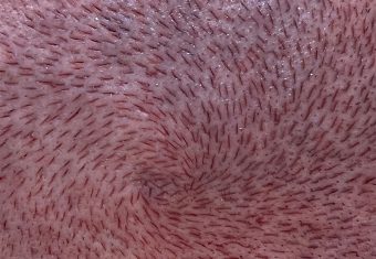 Vertex (Zona Collinare)