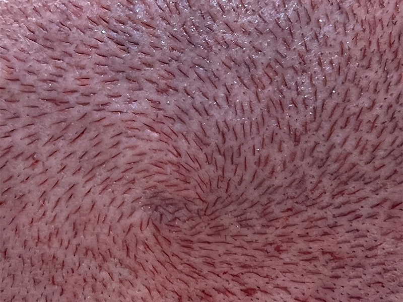 Vertex (Zona Collinare)