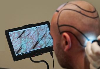 Computerized Hair Analysis