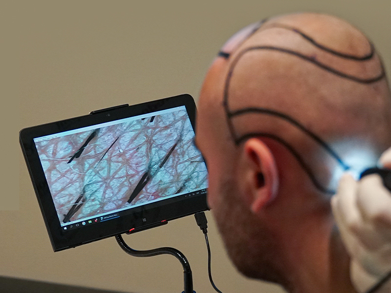 Computerized Hair Analysis