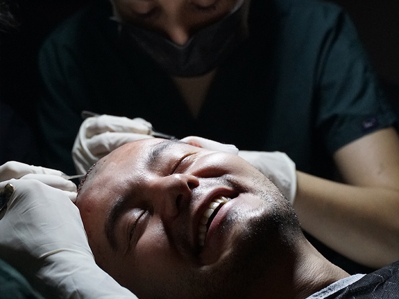 What is Hair Transplant ?